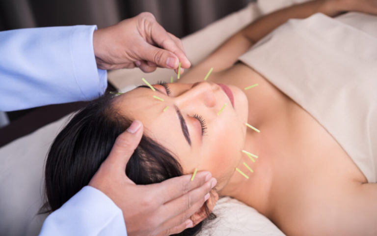 Acupuncture in falls church va